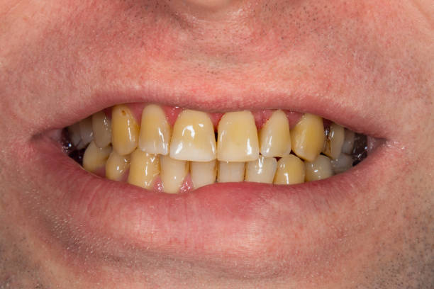 Liquide dentifrice contre la mauvaise haleine