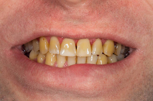 Liquide dentifrice contre la mauvaise haleine